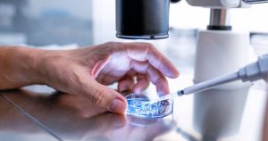 Man produces sperm through testicular tissue frozen in childhood