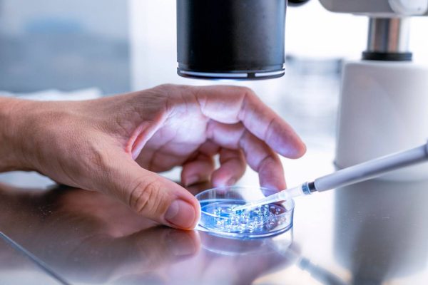 Man produces sperm through testicular tissue frozen in childhood