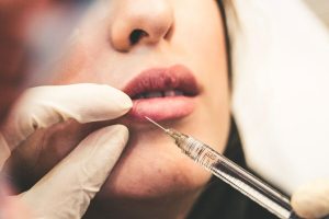 The “face of AI” has arrived. Customers get plastic surgery to look like images generated by ChatGPT