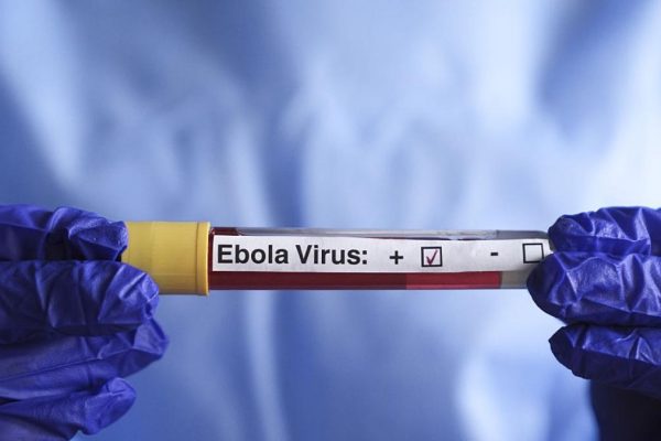 The US position with its citizens exposed to the Ebola outbreak in Africa raises serious doubts: "It could make things worse"
