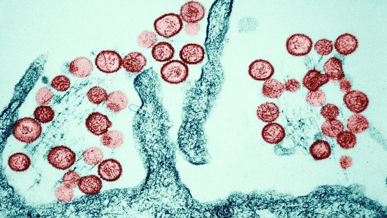 Hantavirus: DGS publishes rules for suspected cases