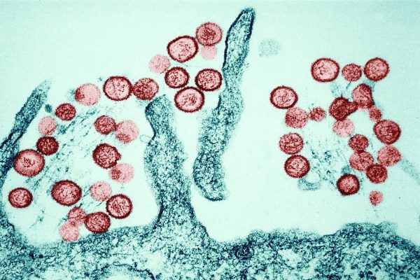 Hantavirus: DGS publishes rules for suspected cases
