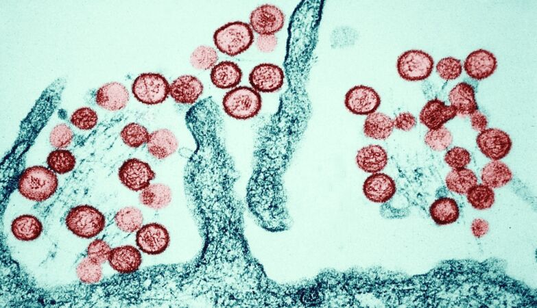 Hantavirus: DGS publishes rules for suspected cases