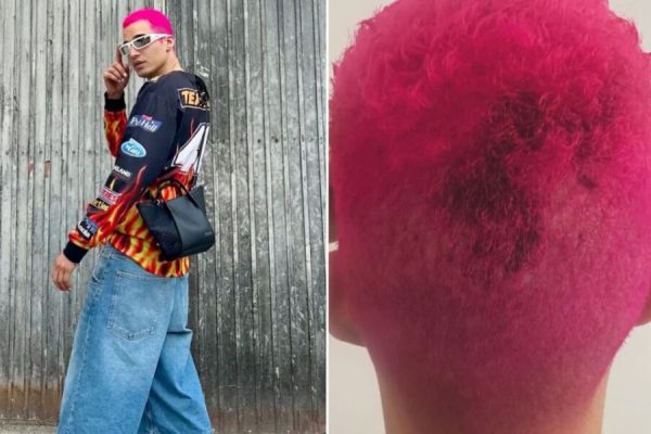 Luís Borges is attacked in the street and shows “marks”: “Today I suffered a homophobic attack…”