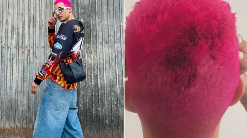 Luís Borges is attacked in the street and shows “marks”: “Today I suffered a homophobic attack…”