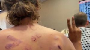 Images of Israel's torture of Flotilla activists: "a place of terror"