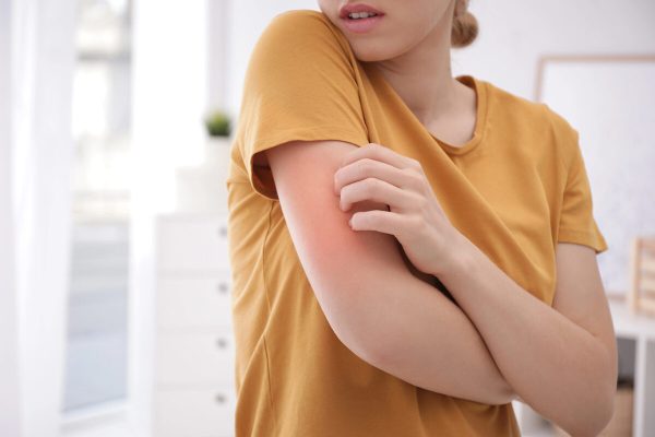 Key to Chronic Itching Relief Discovered