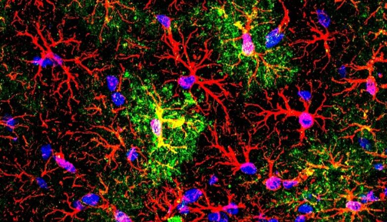 UMinho helps redefine the function of astrocytes in the brain