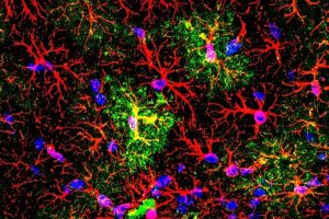 UMinho helps redefine the function of astrocytes in the brain