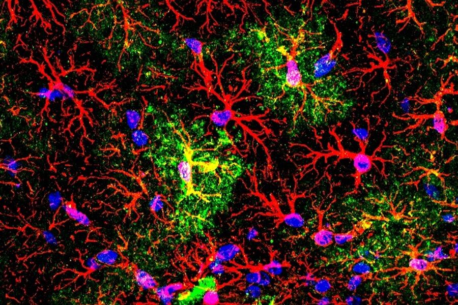UMinho helps redefine the function of astrocytes in the brain