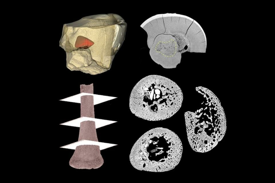 Infant fossils reveal similarities between human and Neanderthal development