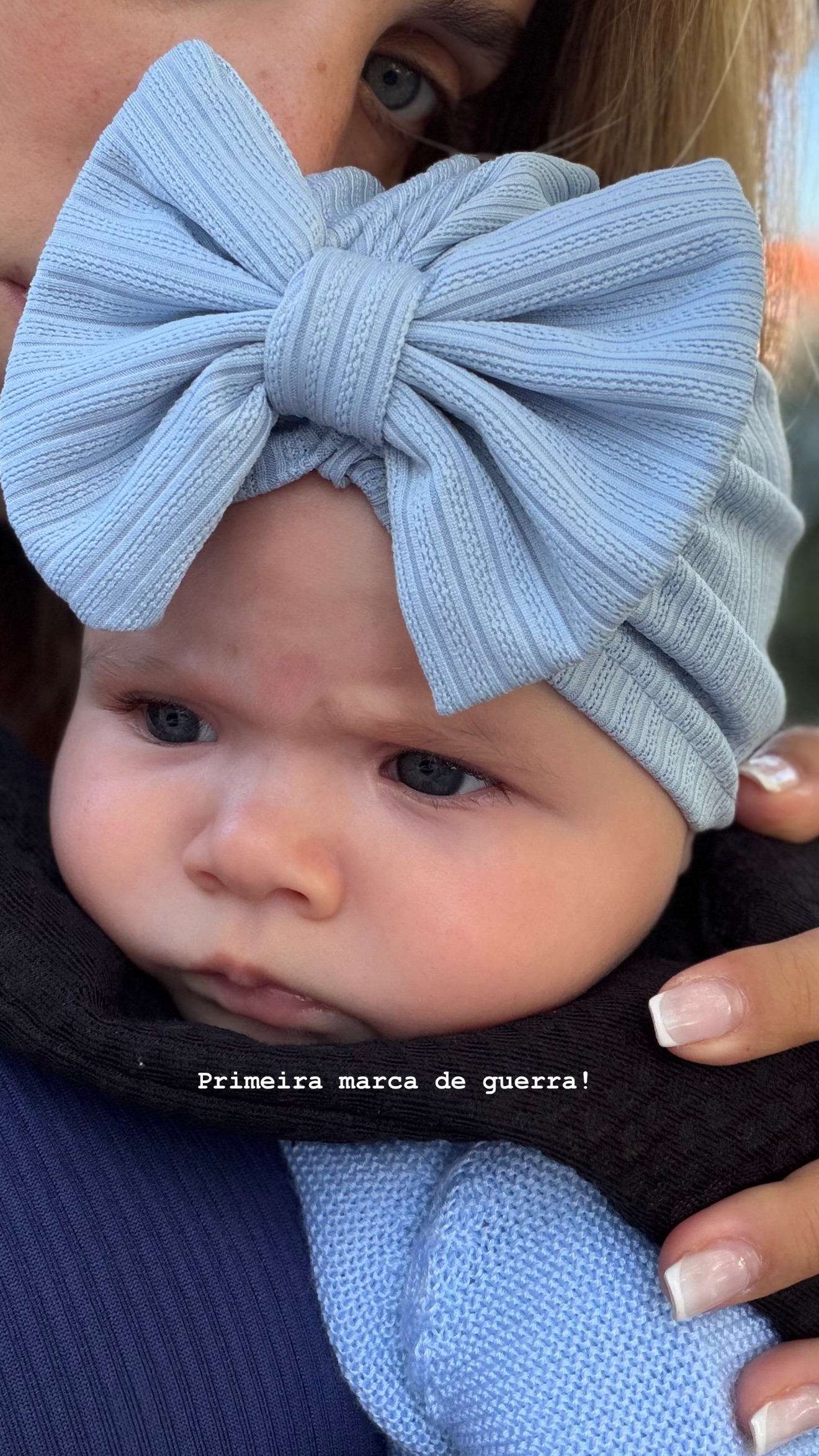 Vânia Sá gets scared with her daughter and shows “war scars”: “She hit her head…”