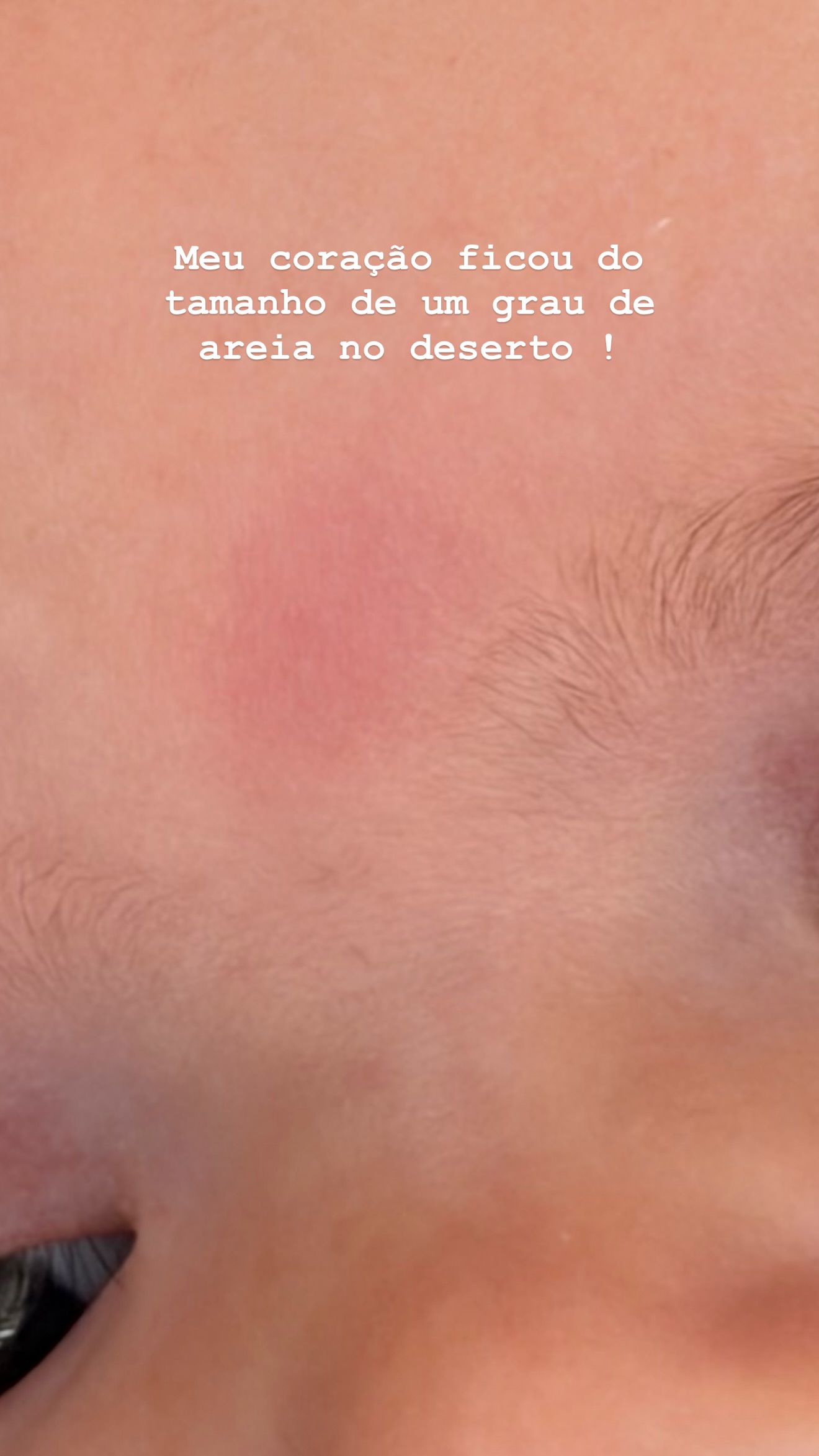 Vânia Sá gets scared with her daughter and shows “war scars”: “She hit her head…”