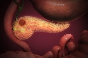 Double “revolution” in the fight against cancer. Oncologists cried