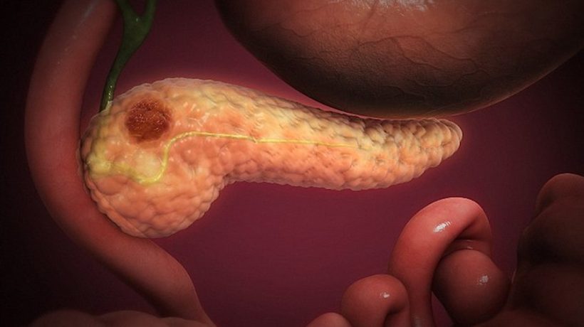 Double “revolution” in the fight against cancer. Oncologists cried