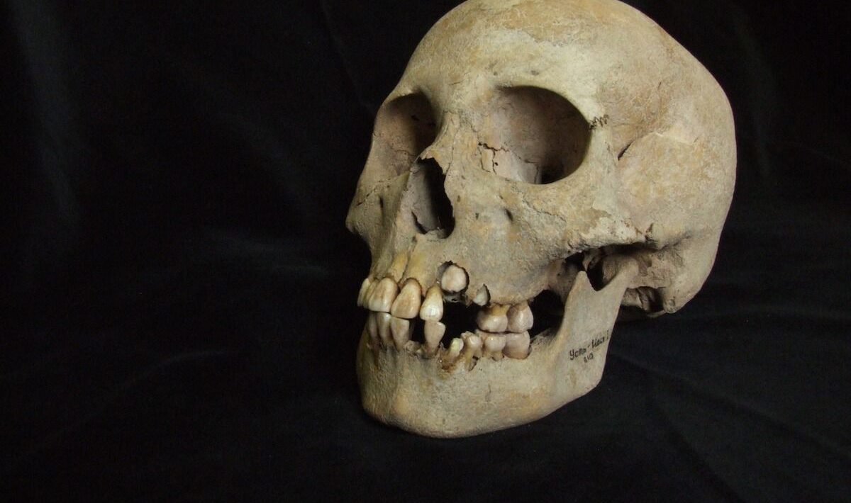 The oldest traces of the Black Death discovered in prehistoric teenagers