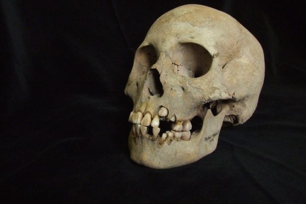 The oldest traces of the Black Death discovered in prehistoric teenagers