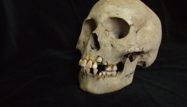 The oldest traces of the Black Death discovered in prehistoric teenagers