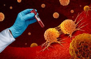 “Liquid Biopsies”: A Blood Test for Multiple Cancers? Not for now