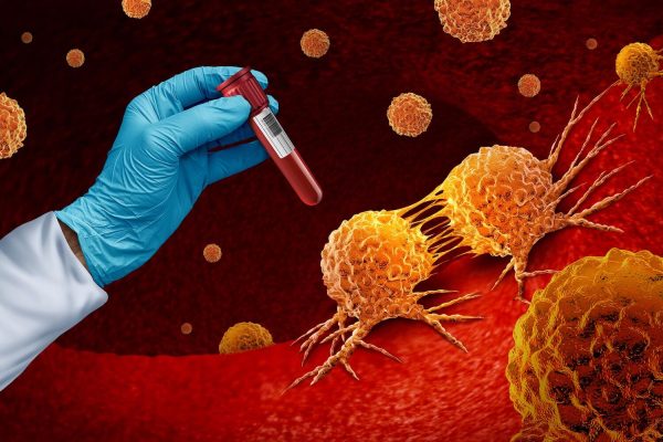 “Liquid Biopsies”: A Blood Test for Multiple Cancers? Not for now