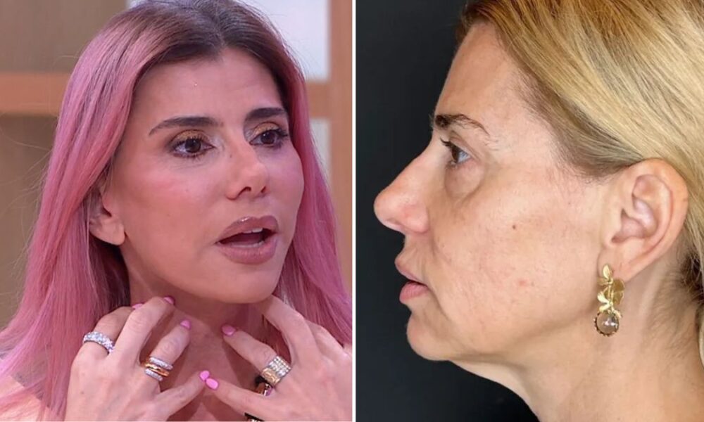 Mônica Sintra recalls “scare” after cosmetic surgery: “When I left, I had no voice…”